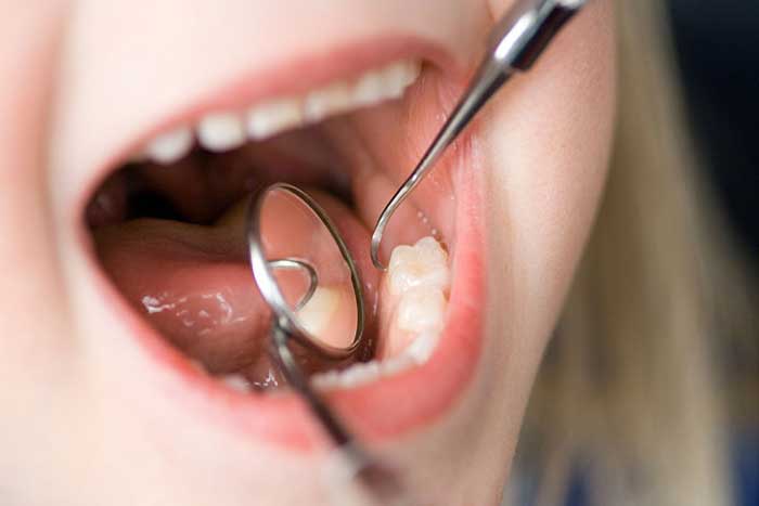 Professional Treatments for Gum Disease