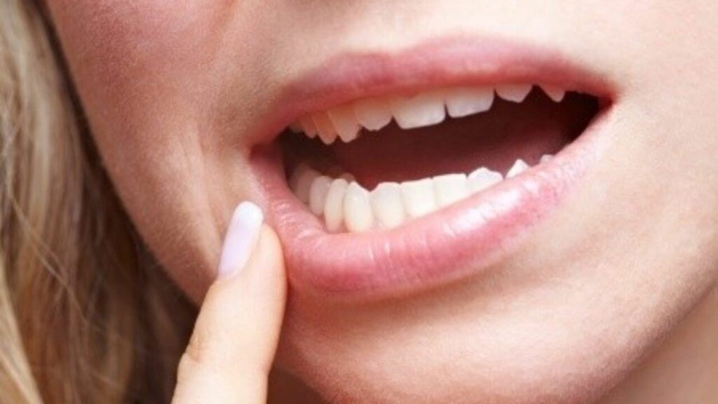 receding gums treatment why Do Gums Recede?