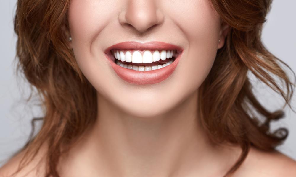 Enhancing Your Smile with Dental Veneers