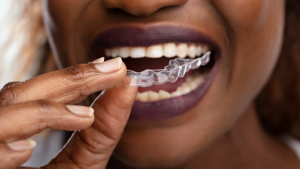 Lifestyle Changes to Manage Bruxism and Gum Disease