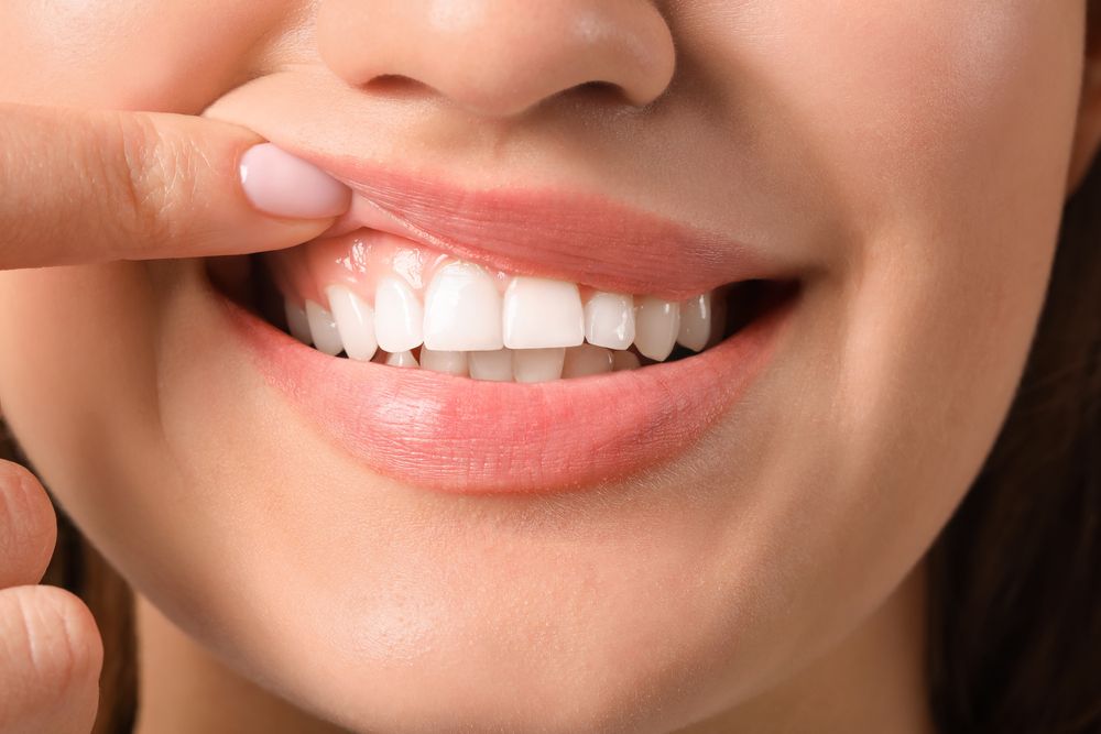 
How To Regrow Your Gums Naturally?